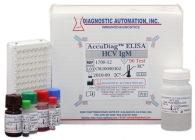 HCV IgM ELISA kit